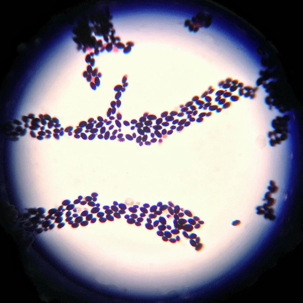 Closeup on the Leuconostoc Cremoris bacteria, a live and active probiotic strain found in our kefir. Thanks to dietitian student Hilda Zvizdich for capturing this image while researching the vitality of Lifeway's bacterial strains.